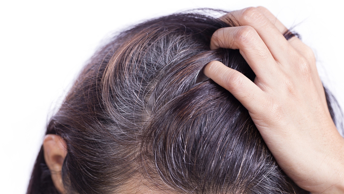 Nguyên nhân nào khiến tóc bạc sớm?